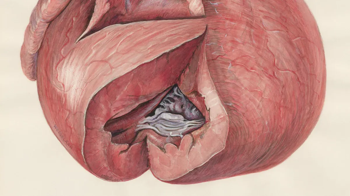 Acid Reflux and GERD