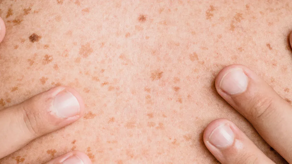 Visible Effects of Oxidative Stress and Aging